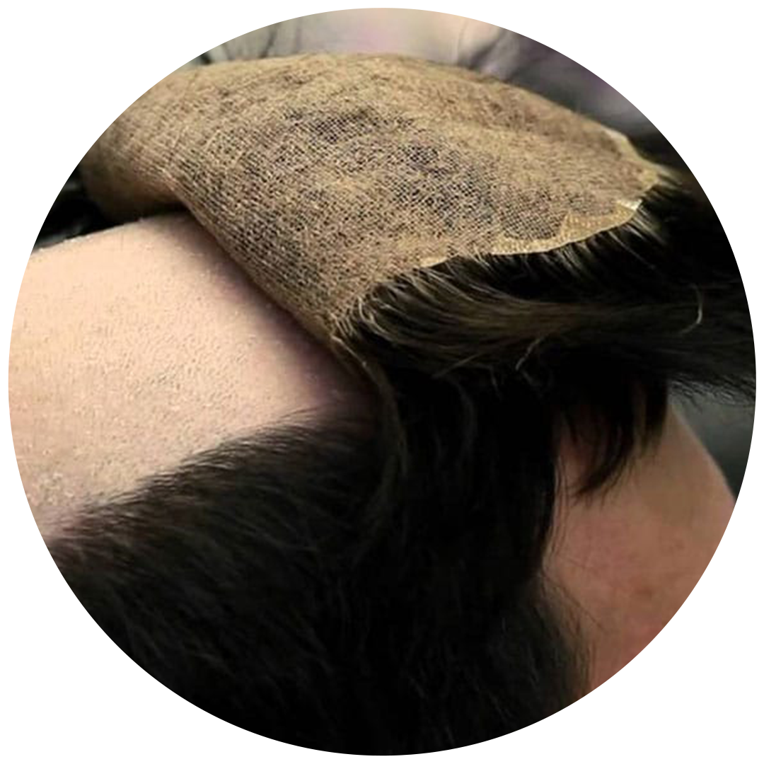 Toupee Installation